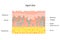 Aged skin layer. Human skin structure with collagen and elastane fibers, hyaluronic acids, fibroblasts. Schematic