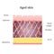 Aged skin layer. Structure human aged skin with collagen and elastin fibers, fibroblasts. Vector diagram