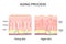 Aging process. comparison of Young and aged skin. Collagen, Elastin and fibroblasts