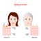 Aging process. comparison of younger, and older skin