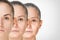 Aging process, rejuvenation anti-aging skin procedures