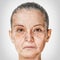 Aging process, rejuvenation anti-aging skin procedures