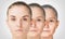 Aging process, rejuvenation anti-aging skin procedures