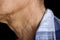 Aging skin folds, creases or wrinkles at neck of Asian old man