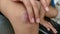 Agirl rubs her fingers with a curative ointment in a bruised knee