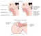 The airway in conscious and unconscious patients