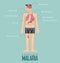 Alarm signs of Malaria infographic in flat design. Malaria disease symptom icon set with human body, skeleton and organ.