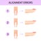 Alignment of the nail plate. Professional manicure guide, Vector illustration, infographics