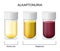 Alkaptonuria. Laboratory flasks with urine