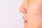 Allergic women have eczema dry nose and lips on winter season closeup.