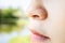 Allergic young woman have eczema dry nose on winter season,female people peeling skin with seborrheic dermatitis,atopic dermatitis