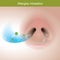 Allergies inhalation. Illustration show close up human nose.