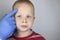 An allergist or dermatologist examines red spots on a childâ€™s face. The boy suffers from a rash, hives and itching. Food Allergy