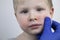 Allergy in the form of redness of the face and rashes, prische in a child. A boy examined by a pediatrician in a hospital.