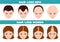 Alopecia stages set. Hair loss stages vector isolated. Female and male alopecia. Set of balding process. Isolated vector