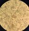 Alternaria fungal spores under the microscope
