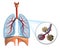 Alveoli in lungs - blood saturating by oxygen