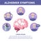 Alzheimer disease symptoms infographic. Memory loss and problem