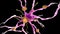 A alzheimer nerve cell