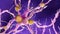 A alzheimer nerve cell