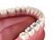 Amalgam restoration. Medically accurate 3D animation of dental concept