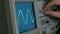 Amplitude Diagram on the oscilloscope. A man presses the buttons on the device. The geometric line changes shape