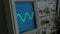 Amplitude Diagram on the oscilloscope. A man presses the buttons on the device. The geometric line changes shape