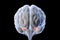 Amygdala, also known as corpus amygdaloideum, in the brain