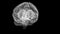 Analyzing of right and left hemispheres of a human brain rotating on dark background.