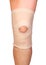 Anatomic knee joint orthosis on leg. Elastic compression bandage