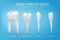 Anatomically realistic illustration of the types of human teeth