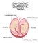 Anatomy of abdomen with twins. Twin types infographic elements in flat design. Monozygotic or Dizygotic Placentation of twins