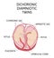 Anatomy of abdomen with twins. Twin types infographic elements in flat design. Monozygotic or Dizygotic Placentation of twins