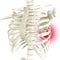 Anatomy and human body. Costochondral separation, separated rib. Broken, fractured ribs. Bones in the rib cage breaks or cracks