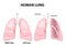 Anatomy of the human lungs