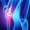 Anatomy of Knee pain isolated in blue