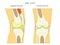 Anatomy of the knee_Sagital and Frontal Section