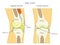 Anatomy of the knee_Sagital and Frontal Section with text