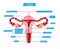 Anatomy of uterus