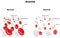 Anemia Diagram