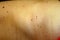 Angioma on the skin. Red moles on the body. Many birthmarks.