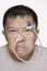 Angry Chinese man with nasogastric tube portrait