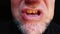 Angry man.Closeup mouth of man with crooked teeth..Unshaven aggressive man swears
