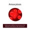 Anisocytosis. Red blood cells of different sizes because of the deficiency of B vitamins, folic acid and iron.