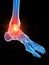 the ankle joint showing pain