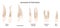 Anomalies of teeth roots. Adult human teeth, molar premolar canine incisor