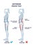Anterior pelvic tilt or APT as pelvis abnormal posture outline diagram
