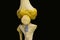 Antero posterior view of articulated femur tibia fibula patella bones showing human knee joint anatomy in isolated black backgroun