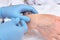 Anti-age injection therapy. Hand rejuvenation.