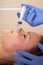 Anti aging facial mesotherapy syringe on woman face